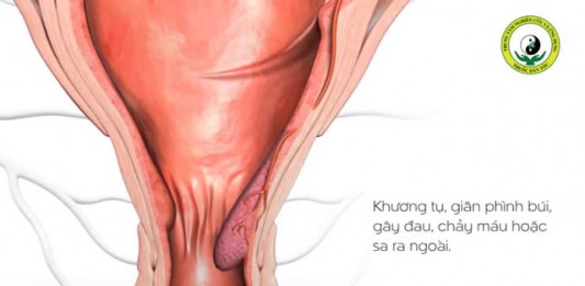 Ảnh bìa video: hình giải phẫu búi trĩ kèm logo An Trĩ Vương
